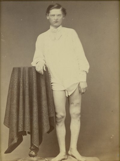 受伤的内战士兵（私人查尔斯韦斯特菲尔德，陆军医学博物馆标本第4278号），1865年4月，1865年（蛋白打印） 作者 威廉·亚伯拉罕·贝尔